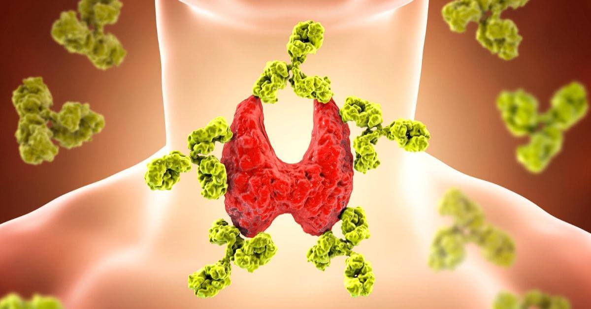 Do Goitrogenic Meals Negatively Affect Thyroid Significance Of Vitamin D In Thyroid Conditions